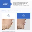 35살에 시작하는 무턱+돌출입 교정 일기 (1) 병원 상담편&lt;부산 연세센텀치과 교정과치과의원&gt;