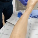 정읍사랑병원 | 무릎 연골 파열 봉합 수술 후 셀프 재활 4개월 차 후기 / 최고의 재활 운동 영상 공유합니다.