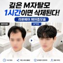 분당헤어 | 남자 헤어증모술 효과 및 가격 총정리! M자 탈모 전문 라본헤어 분당 부산 지점 후기