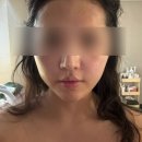 (주)하나조이(hana Joy) | 잠실피부관리 잘하는 곳 조이스킨앤스파 윤곽관리 리얼 후기