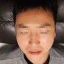 오하다 진정패드 솔트 와 시카패드 미스트세럼 사용후기!