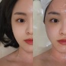 옐로도트/Yellowdot | [리뷰]대전 서구 윤곽관리 맛집, 월평동 에스테틱 : 옐로도트 (하이푸+MTS+물방울관리 찐후기)👍🏻👍🏻