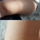 피부해답 네이버블로그