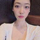 현대성형외과의원 | 압구정 성형외과 눈밑지방재배치수술 후기 2편 (1달차~6주차)