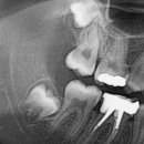 서울사랑니안녕치과의원 이미지