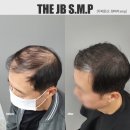 SMP(두피문신) 전문가로 성장하는 마스터 수강과정! 더제이비 6월 개강안내