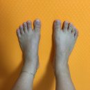 허브힐한의원 - 용인시 처인구 양대로5번길 5 | 발가락교정기 사용 후기
