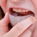 연세밀레니엄치과의원 이미지