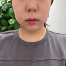 뷰티라인포토신도림 | 모덴스 뷰티랩 : 신도림 윤곽관리 1회만으로 달라진 얼굴라인 후기