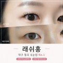 홍의원 | 대구 칠곡 래쉬홍 무쌍 속눈썹 연장 U컬 대만족 후기