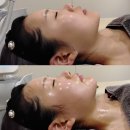 대구한의원 | 대구 율하역 인근 한의원 | 대구한의원최초 리프팅패키지 내돈내산 리얼후기