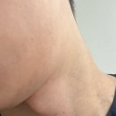 이지현의원 | 제주시 서귀포시 피부과 남자 수염 레이저 제모 3곳 비교 내돈내산 솔직 후기