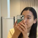 홍 헤어라인 이미지