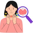 아나젠 | 여자 가르마 탈모 초기 극복 사례 후기