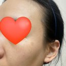 살랑메디 | 메디테라피 비타 리얼 토닉 레이저크림 3주차 후기(진짜 내돈주고 산거)