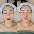 홈123에너지 | [쌍촌동피부관리] 트로이필 추천 민감피부도 가능한 비비에스테틱 내돈내산 후기