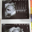 [ 임신 7주 8주 9주] 안산 단원보건소 무료산전검사 엽산받기&amp; 양치덧