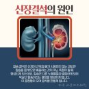 스파라온