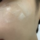 현대제일의원 네이버블로그