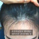 헤어;어느날