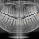 사랑니를부탁해구강악안면외과치과의원 이미지