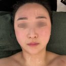 이대전철역 5번출구 | 이대 큐어에스테틱 림프순환관리 오쓰모 스폐셜 관리 후기