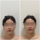 리프핏 | [다산 윤곽관리] 리프핏에서 비대칭 관리 입안마사지 후기 | 물리치료사 출신 원장님 운영