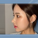 오엠성형외과의원 이미지