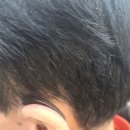 히어보청기 안산센터 네이버블로그
