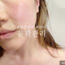 웰뷰티힐러 | [얼굴축소] 인계동 피부관리 웰뷰티힐러 얼굴 윤곽 축소 동안관리 #수원뷰티 #임산부관리