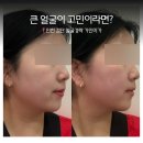 미가 | 인천검단 얼굴 경락샵 추천 가인미가 후기