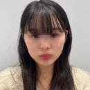 마이멍 | 강남역귀필러 맛집 후기 (내돈내산/전후차이/붓기/멍/통증/가격)