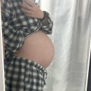 (주)효자로 해뜰날 | 2026_WK12 | 드디어 딱복이 구출!, 겁쟁이의 제왕절개 후기_일산차병원, 일산차병원1인실B타입후기