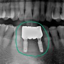 바름치과기공소 이미지