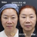 제이소프트 이미지