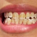 미소필치과의원 이미지