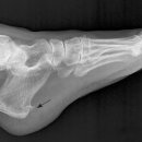 더 케이짐 이미지