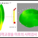 비전클리닉안경원 이미지