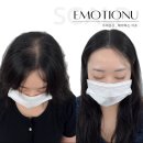 이모션유 | 사랑스러움의 정석 이모션유 헤어라인