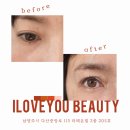 아이클리닉 | 다산 속눈썹펌 아이러브뷰티에서 속눈썹 클리닉 펌 한 솔직후기