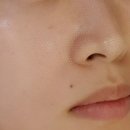 락임뷰티 | 알테온 리프팅으로 여름맞이 피부관리 후기, 이브뷰티센터