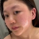 울산 동구 가온에스테틱 동구예신관리 윤곽관리맛집 울산윤곽전문점