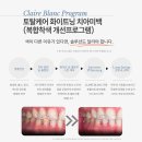 부일치과의원 | 미백후기 좋은 치과 찾는다면? 치아미백 전 꼭 알아야 할 3가지