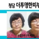 TLT 전주점 | 청담동 피부과 :: 스컬트라 잘하는곳 2차 후기