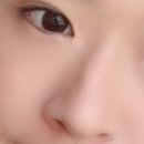 울산대학병원 비중격만곡증 매부리코 수술 후기 재업,,,