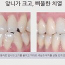 매일미소치과의원 네이버블로그