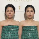 오직얼굴연구소 | 목동 피부관리 1회만으로 효과본 '쏘영피부연구소 목동본점' 후기