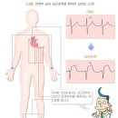 허혈심장질환 분류표[별표-질병관련14] 이미지