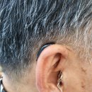 열린보청기 이미지