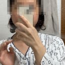 화순전남대학교병원 | 갑상선암 동위원소치료(옥소치료) 저요오드 식단, 입원 준비물, 입원 과정, 부작용 [화순전남대학교병원]